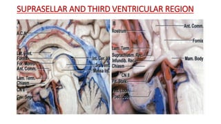 SUPRASELLAR AND THIRD VENTRICULAR REGION
 