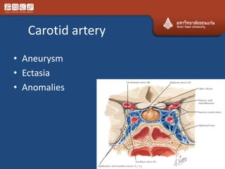 Carotid artery
• Aneurysm
• Ectasia
• Anomalies
 