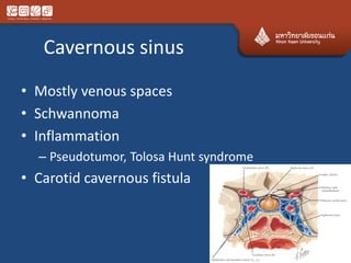 Cavernous sinus
• Mostly venous spaces
• Schwannoma
• Inflammation
– Pseudotumor, Tolosa Hunt syndrome
• Carotid cavernous fistula
 