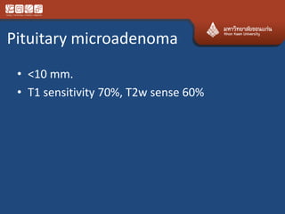 Pituitary microadenoma
• <10 mm.
• T1 sensitivity 70%, T2w sense 60%
 