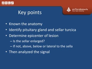 Key points
• Known the anatomy
• Identify pituitary gland and sellar turcica
• Determine epicenter of lesion
– Is the sellar enlarged?
– If not, above, below or lateral to the sella
• Then analyzed the signal
 