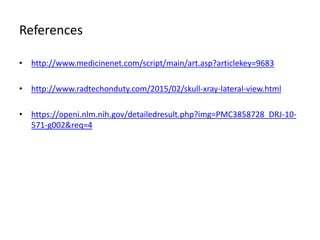 References
• http://www.medicinenet.com/script/main/art.asp?articlekey=9683
• http://www.radtechonduty.com/2015/02/skull-xray-lateral-view.html
• https://openi.nlm.nih.gov/detailedresult.php?img=PMC3858728_DRJ-10-
571-g002&req=4
 