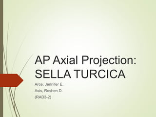 AP Axial Projection:
SELLA TURCICA
Arce, Jennifer E.
Asis, Roshen D.
(RAD3-2)
 
