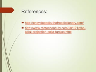 References:
 http://encyclopedia.thefreedictionary.com/
 http://www.radtechonduty.com/2013/12/ap-
axial-projection-sella-turcica.html
 