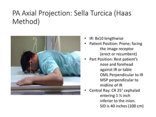 PA Axial Projection: Sella Turcica (Haas
Method)
• IR: 8x10 lengthwise
• Patient Position: Prone; facing
the image receptor
(erect or recumbent)
• Part Position: Rest patient’s
nose and forehead
against IR or table
OML Perpendicular to IR
MSP perpendicular to
midline of IR
• Central Ray: CR 25° cephalad
entering 1 ½ inch
inferior to the inion.
SID is 40 inches (100 cm)
 