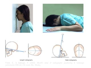 Frank, E., & Ballinger, P. (2003). Merrill's atlas of radiographic positioning & radiologic
procedures (10th ed.). St. Louis, Mo.: Mosby.
 