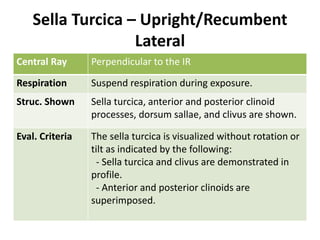 Sella Turcica – Upright/Recumbent
Lateral
Central Ray Perpendicular to the IR
Respiration Suspend respiration during exposure.
Struc. Shown Sella turcica, anterior and posterior clinoid
processes, dorsum sallae, and clivus are shown.
Eval. Criteria The sella turcica is visualized without rotation or
tilt as indicated by the following:
- Sella turcica and clivus are demonstrated in
profile.
- Anterior and posterior clinoids are
superimposed.
 