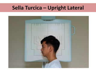Sella Turcica – Upright Lateral
 