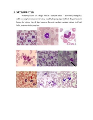 3. NETROFIL STAB
Mempunyai ciri -ciri sebagai berikut : diameter antara 14-30 mikron, mempunyai
nukleous yang berbentuk seperti batang huruf T, lonjong, dapat berlekuk dengan kromatin
kasar, sito plasnia banyak dan berwarna kemerah-merahan. dengan granula kecil-kecil
halus berwarna lembayung uda.
 