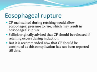 Eosophageal rupture
 CP maintained during retching would allow
eosophageal pressure to rise, which may result in
eosophageal rupture.
 Sellick originally advised that CP should be released if
retching occurs during induction.
 But it is recommended now that CP should be
continued as this complication has not been reported
till date.
 