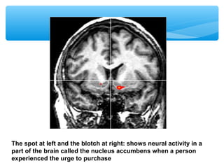 The spot at left and the blotch at right: shows neural activity in a
part of the brain called the nucleus accumbens when a person
experienced the urge to purchase
 