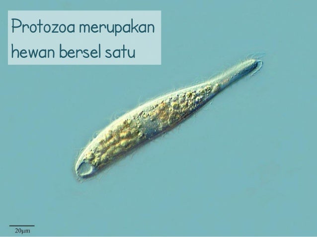 Sel Prokariot vs Eukariot