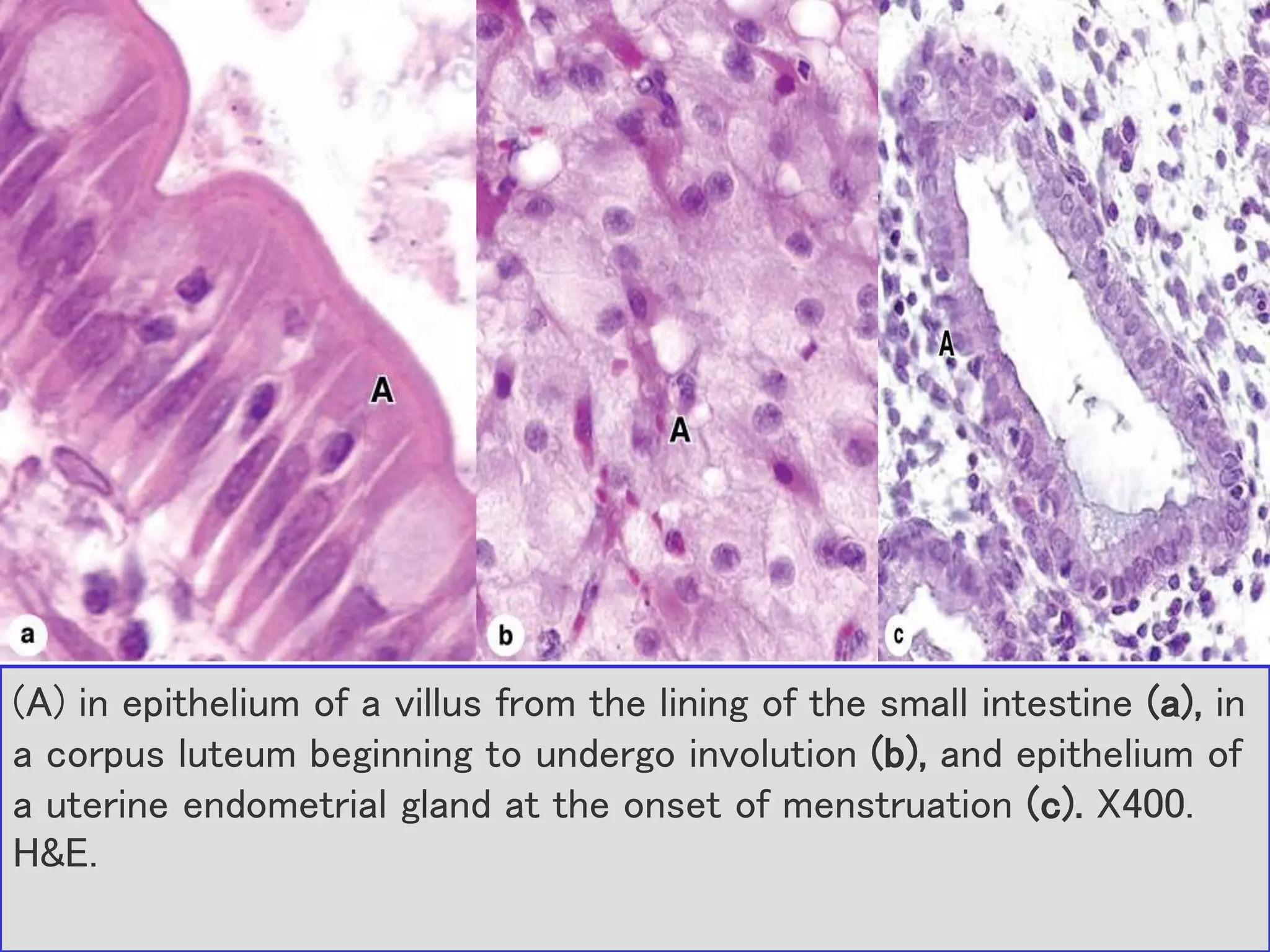 Apoptosis & Necrosis | PPTX