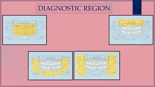 DIAGNOSTIC REGION
 