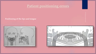 Patient positioning errors
Positioning of the lips and tongue
 