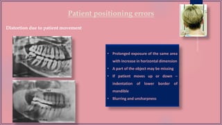 Patient positioning errors
Distortion due to patient movement
• Prolonged exposure of the same area
with increase in horizontal dimension
• A part of the object may be missing
• If patient moves up or down –
indentation of lower border of
mandible
• Blurring and unsharpness
 