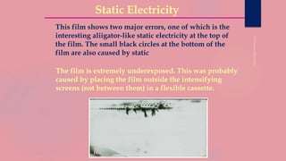 Static Electricity
R L
This film shows two major errors, one of which is the
interesting aliigator-like static electricity at the top of
the film. The small black circles at the bottom of the
film are also caused by static
The film is extremely underexposed. This was probably
caused by placing the film outside the intensifying
screens (not between them) in a flexible cassette.
 