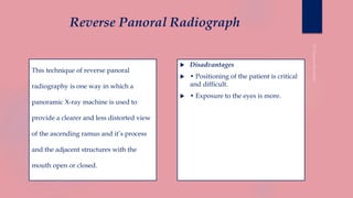 Reverse Panoral Radiograph
 Disadvantages
 • Positioning of the patient is critical
and difficult.
 • Exposure to the eyes is more.
This technique of reverse panoral
radiography is one way in which a
panoramic X-ray machine is used to
provide a clearer and less distorted view
of the ascending ramus and it’s process
and the adjacent structures with the
mouth open or closed.
 