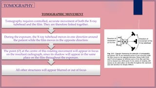 TOMOGRAPHY
TOMOGRAPHIC MOVEMENT
All other structures will appear blurred or out of focus
The point (O) at the centre of this rotating movement will appear in focus
on the resultant radiograph, since its shadow will appear in the same
place on the film throughout the exposure.
During the exposure, the X-ray tubehead moves in one direction around
the patient while the film moves in the opposite direction.
Tomography requires controlled, accurate movement of both the X-ray
tubehead and the film. They are therefore linked together.
 