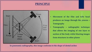 PRINCIPLE
• Movement of the film and tube head
produces an image through the process –
Tomography
• Tomography – radiographic technique
that allows the imaging of one layer or
section of the body while blurring images
from structures in other planes
In panoramic radiography, this image conforms to the shape of dental arches
 