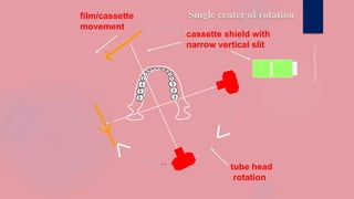 Single center of rotation
cassette shield with
narrow vertical slit
tube head
rotation
film/cassette
movement
 