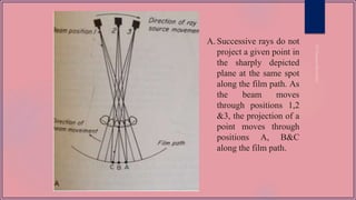 A. Successive rays do not
project a given point in
the sharply depicted
plane at the same spot
along the film path. As
the beam moves
through positions 1,2
&3, the projection of a
point moves through
positions A, B&C
along the film path.
 
