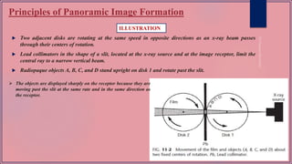 Principles of Panoramic Image Formation
 Two adjacent disks are rotating at the same speed in opposite directions as an x-ray beam passes
through their centers of rotation.
 Lead collimators in the shape of a slit, located at the x-ray source and at the image receptor, limit the
central ray to a narrow vertical beam.
 Radiopaque objects A, B, C, and D stand upright on disk 1 and rotate past the slit.
ILLUSTRATION
 The objects are displayed sharply on the receptor because they are
moving past the slit at the same rate and in the same direction as
the receptor.
 