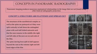 CONCEPTS IN PANORAMIC RADIOGRAPHY
Panoramic imaging produces numerous anatomical relationships in the image that are not found in any
other kind of radiographic projection.
The structures of the maxillofacial complex as
well as the spine are portrayed as if they were
split vertically in half down the midsagittal
plane with each half folded outwards such
that the nose remains in the middle ;the right
and left sides of the jaws are on each side of
the film.
The spine ;having been split in half appears
beyond the rami at the extreme right and left
hand edges of the film
CONCEPT 1: STRUCTURES ARE FLATTENED AND SPREAD OUT
 