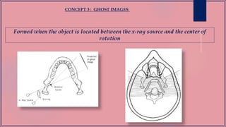 Formed when the object is located between the x-ray source and the center of
rotation
CONCEPT 3 : GHOST IMAGES
 