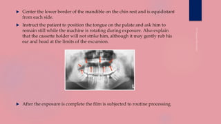  Center the lower border of the mandible on the chin rest and is equidistant
from each side.
 Instruct the patient to position the tongue on the palate and ask him to
remain still while the machine is rotating during exposure. Also explain
that the cassette holder will not strike him, although it may gently rub his
ear and head at the limits of the excursion.
 After the exposure is complete the film is subjected to routine processing.
 
