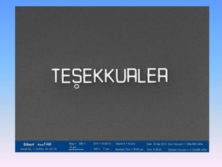 Taramalı Elektron Mikroskobu