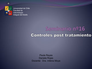 Universidad de Chile 
Facultad de 
Odontología 
Integral del Adulto 
Paula Reyes 
Daniela Rojas 
Docente: Dra. milena Moya 
 
