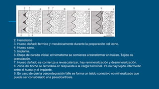 2. Hematoma
3. Hueso dañado térmica y mecánicamente durante la preparación del lecho.
4. Hueso sano.
5. Implante.
6. Etapa de curado inicial, el hematoma se comienza a transformar en hueso. Tejido de
granulación.
7. Hueso dañado se comienza a revascularizar, hay remineralización y desmineralización.
8. Zona del borde se remodela en respuesta a la carga funcional. Ya no hay tejido intermedio
entre el hueso y el implante.
9. En caso de que la oseointegración falle se forma un tejido conectivo no mineralizado que
puede ser considerado una pseudoartrosis.
 