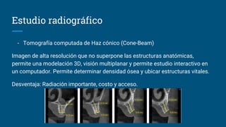 Estudio radiográfico
- Tomografía computada de Haz cónico (Cone-Beam)
Imagen de alta resolución que no superpone las estructuras anatómicas,
permite una modelación 3D, visión multiplanar y permite estudio interactivo en
un computador. Permite determinar densidad ósea y ubicar estructuras vitales.
Desventaja: Radiación importante, costo y acceso.
 