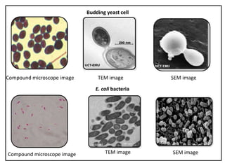 Compound microscope image TEM image
Budding yeast cell
E. coli bacteria
Compound microscope image TEM image SEM image
SEM image
 