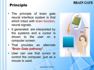 Braingate | PPTX