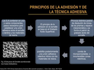 PRINCIPIOS DE LA ADHESIÓN Y DE
LA TÉCNICA ADHESIVA
Los S.A contienen en uno
o varios componentes,
pasos necesarios para
establecer una unión
adhesiva entre el esmalte
o dentina y los materiales
de resina.
El principio de la
adhesión en el esmalte
se basa en el Grabado
Ácido Superficial.
Provoca distintos grados
de disolución de zonas
de los prismas y espacio
interprismático y se
forma el patrón de
grabado ácido del
esmalte.
consta de
microporosidades e
innumerables zonas
retentivas.
posibilita posteriormente
una unión adhesiva
retentiva íntima con los
materiales de resina.
Fig. 6 Estructura de Esmalte acondicionada
Con Ácido Ortofosfórico
Arana E.M. 1974 Clinical observations of enamel after acid etch procedure. J. Amer. Dent. Assoc. 89:1102-6
 