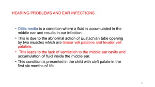 cleft lip and palate in orthodontics.pptx