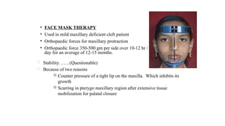 Mobilisation Mask cleft lip and palate in orthodontics.pptx