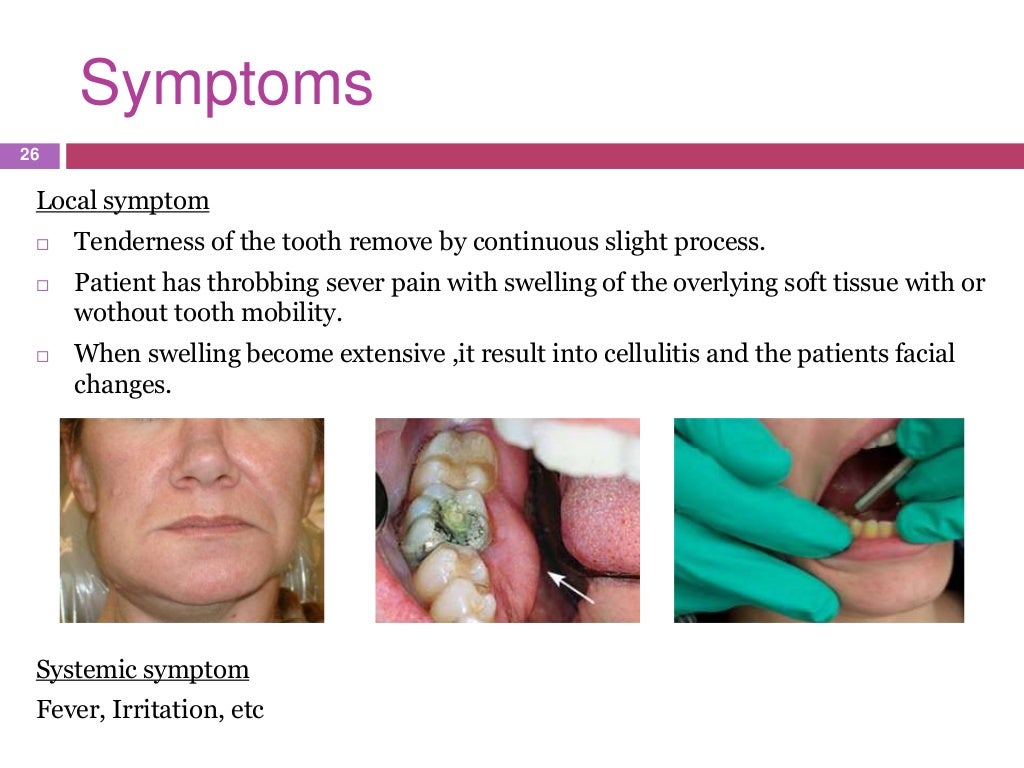 endodontic emergencies
