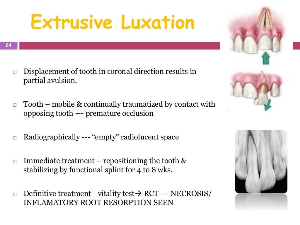 endodontic emergencies
