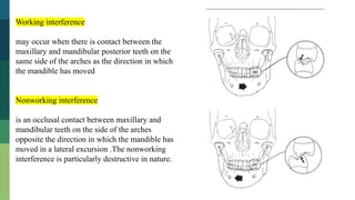 Lateral Excursion Interferences Fundamentals of occlusion Fixed partidal denture | PPTX