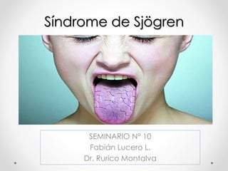 SEMINARIO N° 10
Fabián Lucero L.
Dr. Rurico Montalva
Síndrome de Sjögren
 