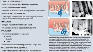 Using Slob Rule Radiograph SEM 14 DIAGNOSTIC IMAGING IN ENDODOTICS AND CONSERVATIVE DENTISTRY | PPTX