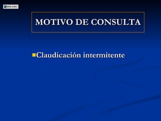 MOTIVO DE CONSULTA Claudicación intermitente 