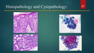 Histopathology and Cytopathology: 87
 