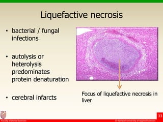Necrosis And Degeneration PPTX necrosis-and-degeneration-pptx