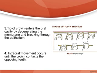 3.Tip of crown enters the oral
cavity by degenerating the
membrane and breaking through
the epithelium.
4. Intraoral movement occurs
until the crown contacts the
opposing teeth.
 