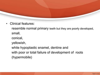 • Clinical features:
resemble normal primary teeth but they are poorly developed,
small,
conical,
yellowish,
white hypoplastic enamel, dentine and
with poor or total failure of development of roots
(hypermobile)
 
