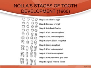 NOLLA’S STAGES OF TOOTH
DEVELOPMENT (1960)
 
